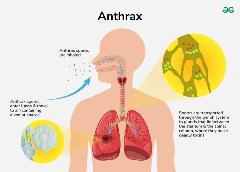 Anthrax